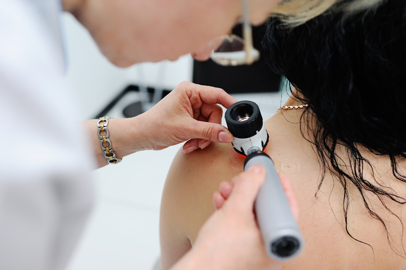 melanoma diagnosis. the doctor examines the patient's mole dermatology services in Cheyenne, WY